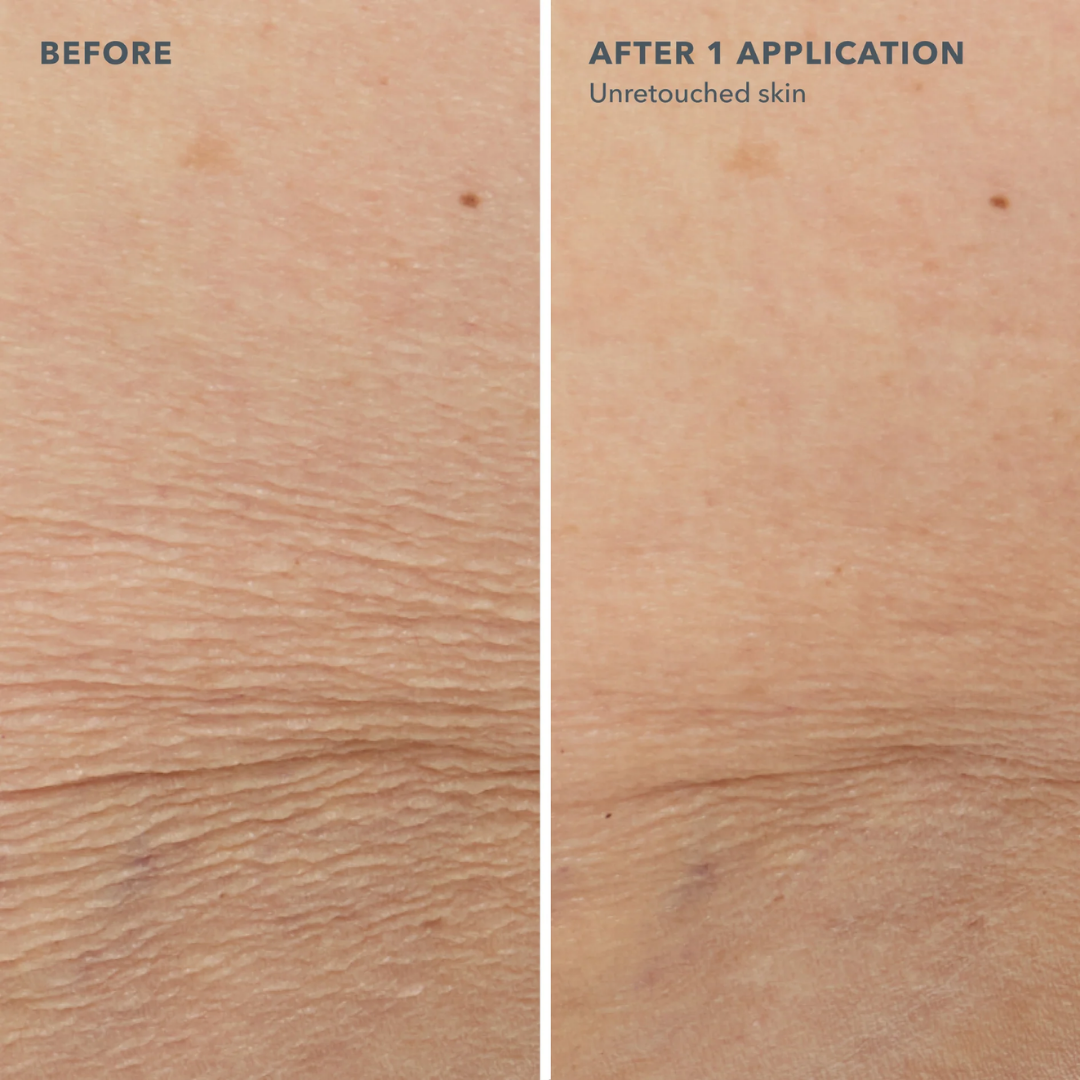 Before and after comparison of skin texture with 'Before' showing more visible lines and 'After 1 Application' showing smoother skin.