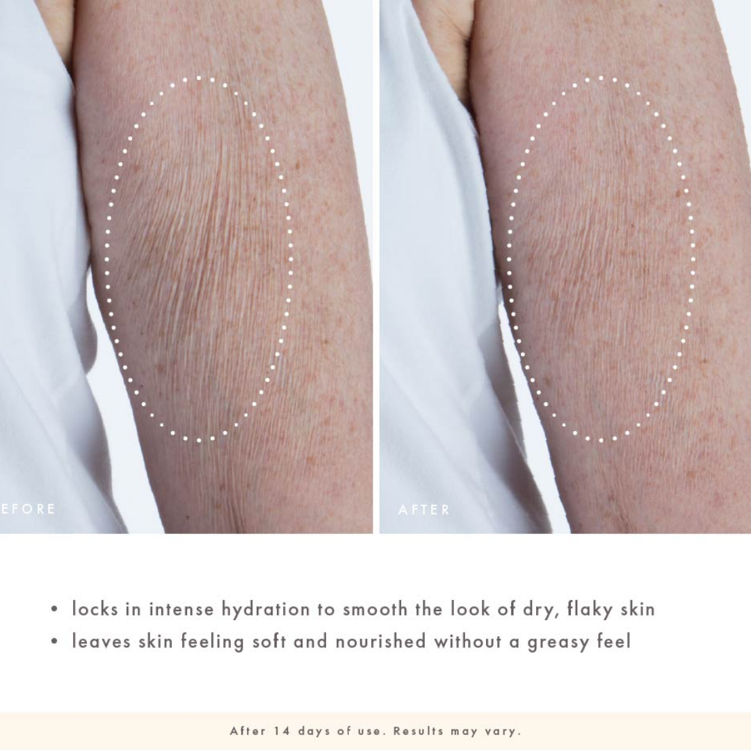 Before-and-after comparison of skin on a person's arm, showing dry, flaky skin in the left 'before' panel and smoother, hydrated skin in the right 'after' panel. Text below describes hydration and softness benefits.