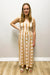 Woman wearing a striped dress standing against a plain white wall.